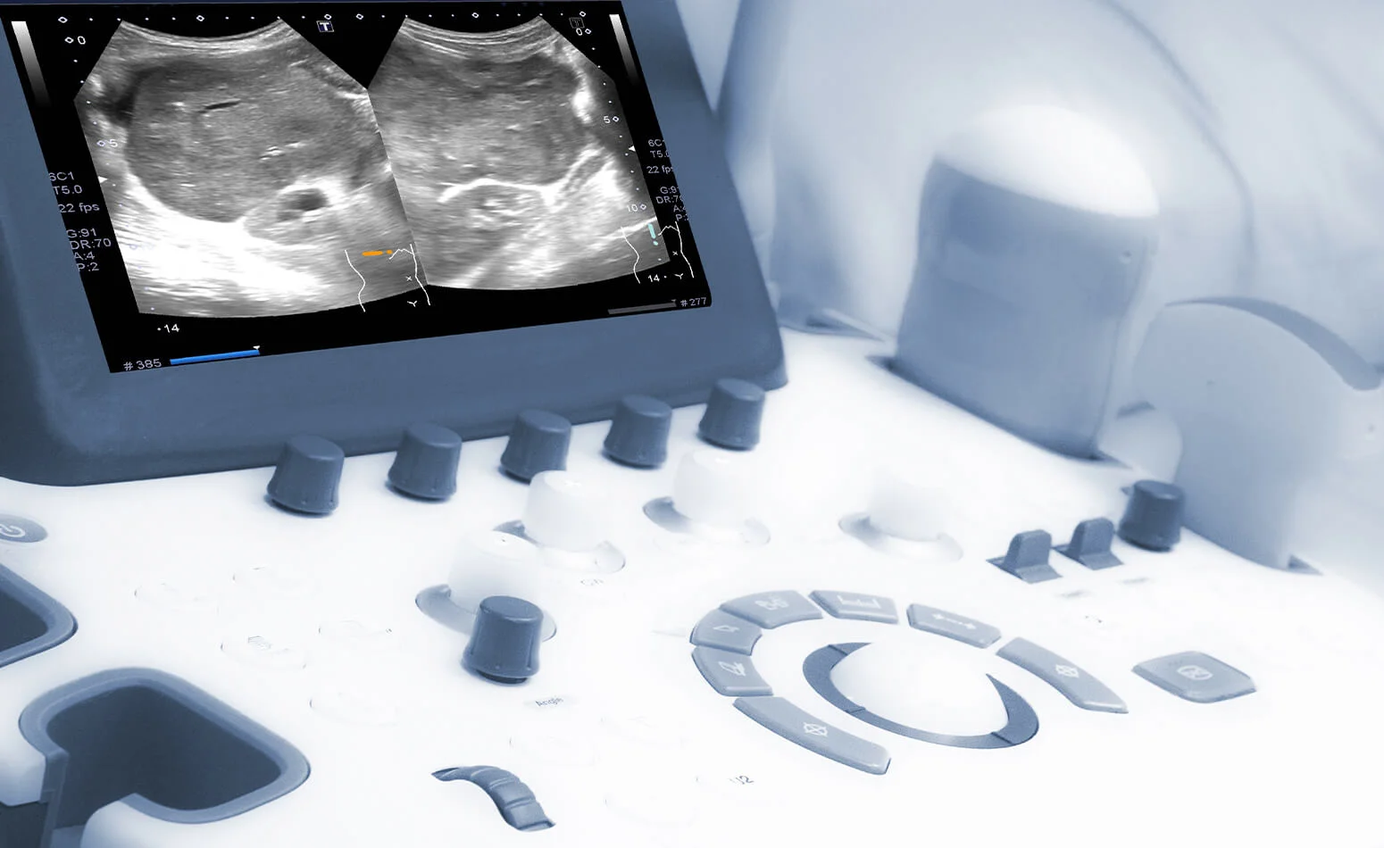Roosevelt Cardiovascular Diagnostic